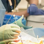 بیوپسی چیست؟