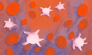 پلاکت پایین خون