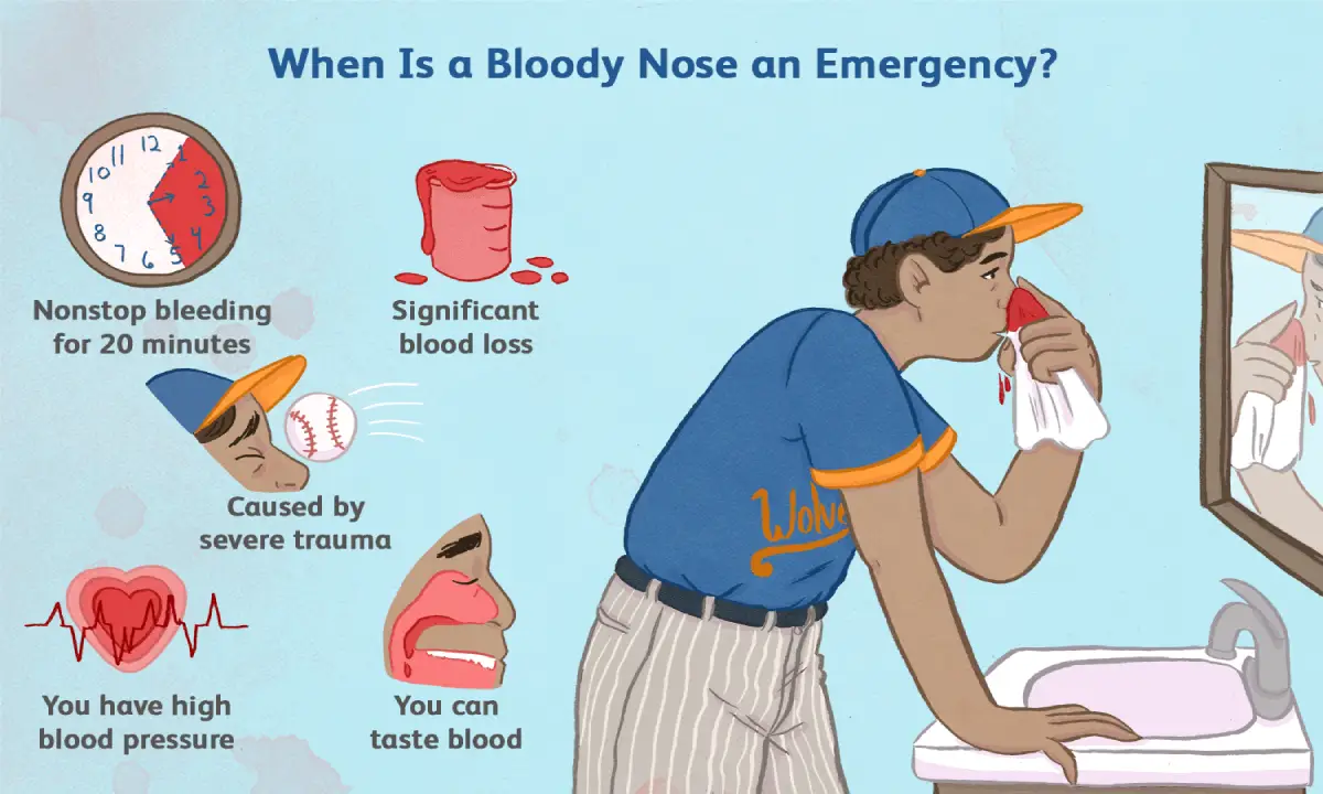 علت خون دماغ شدن از سوراخ چپ بینی